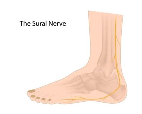 Sural Nerve Pain | Ease your Sural Nerve Pain