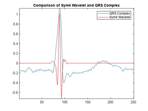 R Wave Detection in the ECG - MATLAB & Simulink - MathWorks India