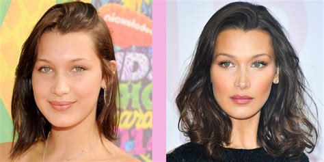 Bella Hadid Plastic Surgery - The Supermodel Discussed Whether she's had Cosmetic Surgery on her ...