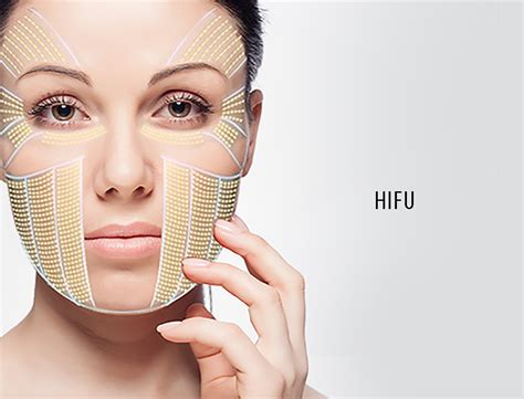 Hifu Treatment For Face, Hifu Facelift Cost, Hifu Facelift Treatment