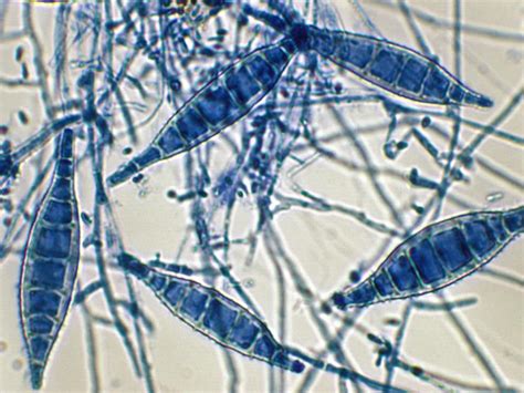 Microsporum | Mycology | University of Adelaide