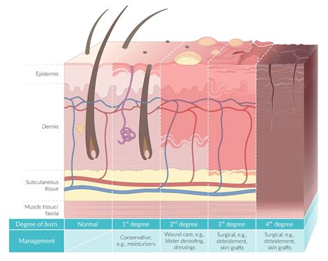 Fourth Degree Burn Diagram