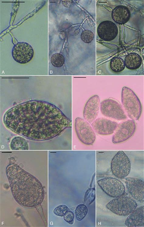 Morphological data. (A) Terminal chlamydospore of P. chlamydospora, bar... | Download Scientific ...