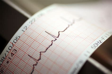 How to Become an Echocardiogram Technician - KEY TO INFO