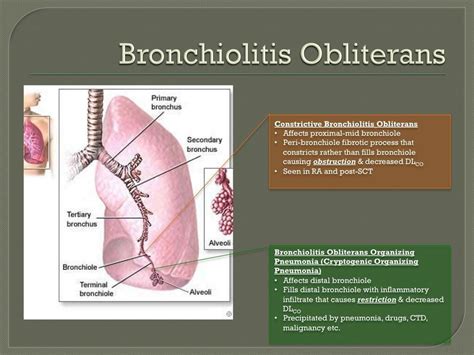 Bronchiolitis Obliterans | Medical Coverage | Harrisburg, IL