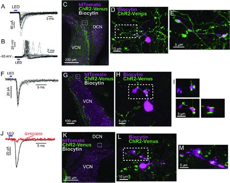 Three additional examples of granule cells with anatomically and... | Download Scientific Diagram