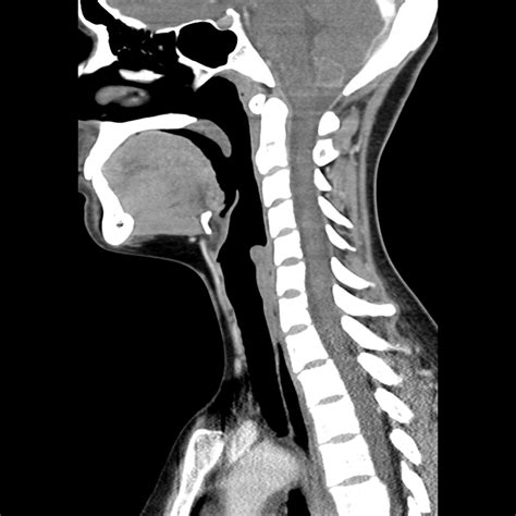 ct scan neck anatomy Car Tuning