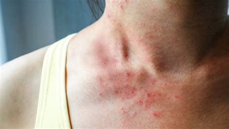 10 Things Itchy Skin Says About Your Health