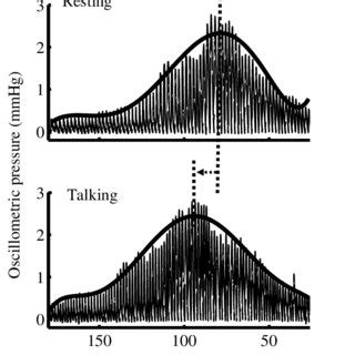 Illustration of a shift of the oscillometric pulse waveform envelope... | Download Scientific ...