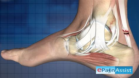 Ankle Joint Arthroscopy-Therapeutic : Ankle Arthroscopic Surgery, Examination, Treatment - YouTube