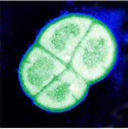 Deinococcus radiodurans NEU2011 - microbewiki