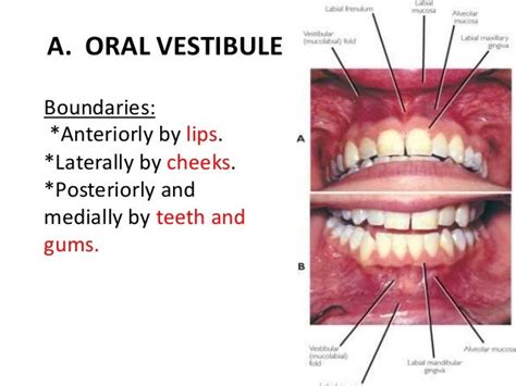 Vestibule Oral Cavity Anatomy