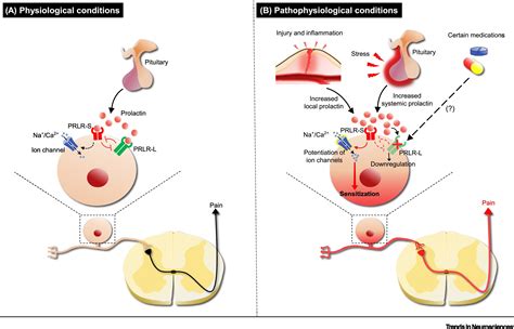 An Emerging Role for Prolactin in Female-Selective Pain: Trends in Neurosciences