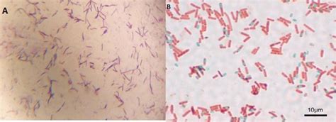 (A) Strain G9: Gram’s staining (Gram positive rod shaped bacteria ...