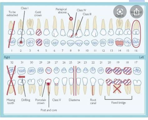 Dental Charting Symbols Chart