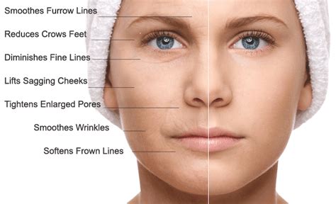 Stem Cell/PRP Facial Rejuvenation - New Image Advanced Laser Skin Center - Las Vegas