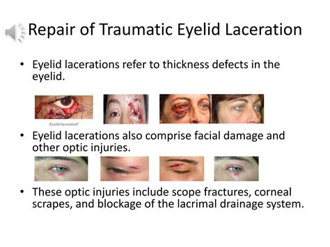 SOLUTION: Repair of traumatic eyelid laceration - Studypool