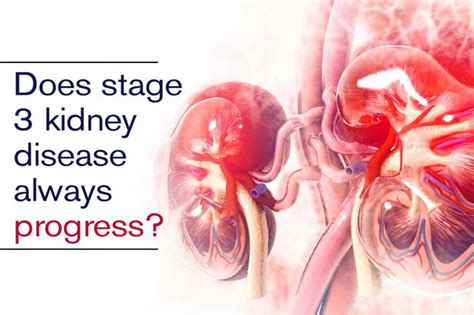 Reduce stage 3 kidney disease through Ayurvedic medicine | Stage 3 kidney disease, Kidney ...