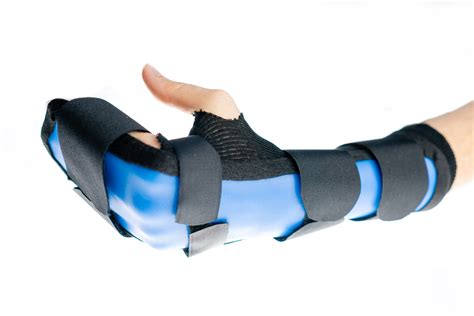 Tendon Diagram Of Hand Wrist Injuries Emcage Tendon R - vrogue.co