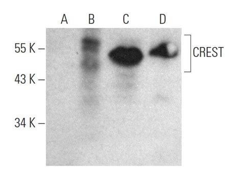 CREST Antibody (G-8) | SCBT - Santa Cruz Biotechnology