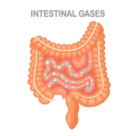 Feels Like Bubbles Popping In My Stomach (9 Possible Causes & How To Get Rid Of Stomach Gas ...