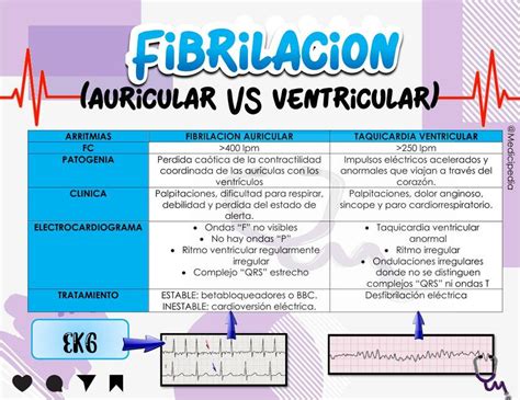 Examinar detenidamente tierra Th arritmia auricular y ventricular Toro ...