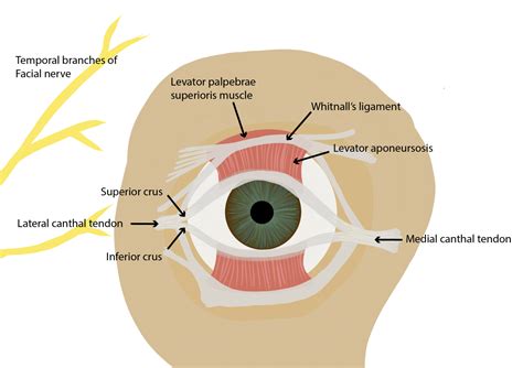 How to perform a lateral canthotomy - EyeGuru