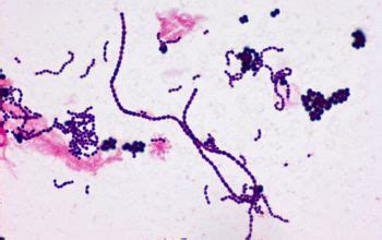 Streptococcus oralis