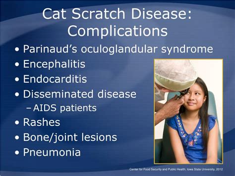 PPT - Cat Scratch Disease and Other Bartonella Infections PowerPoint Presentation - ID:5081632