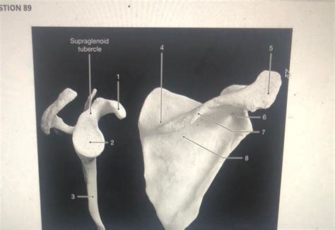 Solved STION 89 Supraglenoid tubercle 5 2. Identity the | Chegg.com