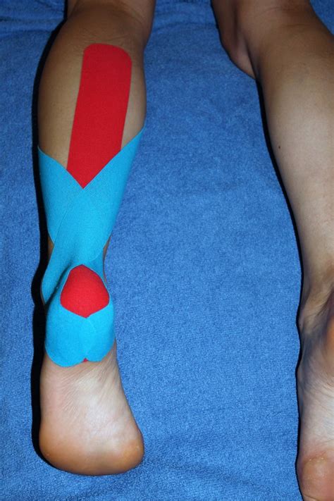 Kinesiology Taping for the Achilles Tendon - UKRunChat