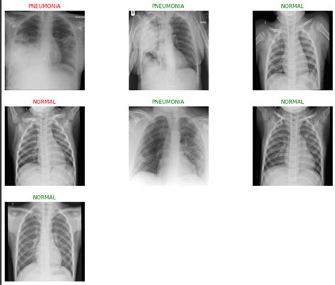 GitHub - Sinchana-SH/AI-model-to-predict-covid19: AI-model-to-predict-covid19 using CNN AND ...