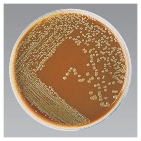 Chocolate Agar Medium - Pack of 10