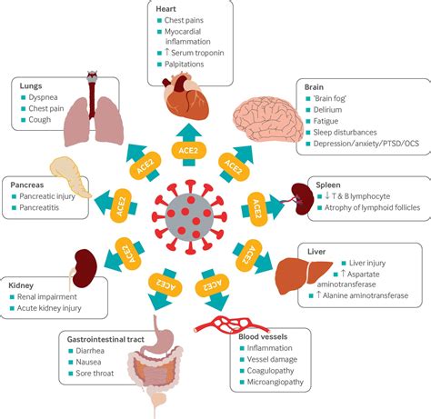 Information about Coronavirus (COVID-19) [ARCHIVE] | NRAS