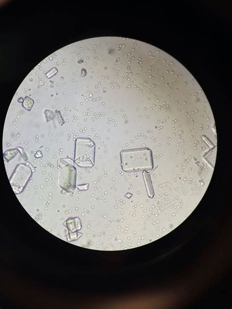 Struvite crystals from a cats urine sample | Cat urine, Urinal, Music record