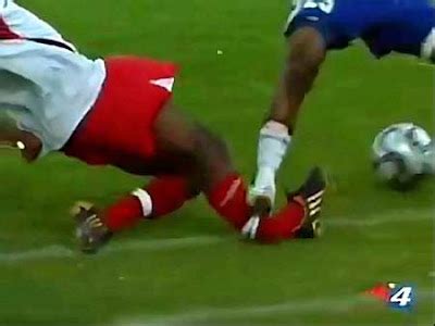 World’s Worst Football Sports injuries-Soccer injury ever