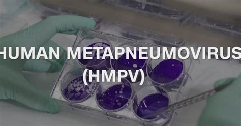 HMPV symptoms: How to know if you have human metapneumovirus and how to treat it | Flipboard