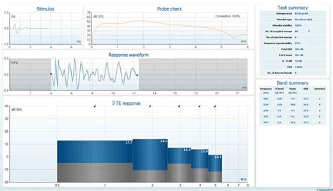 Otoacoustic emissions (OAEs) for ototoxicity monitoring