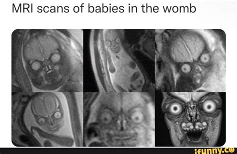 MRI scans of babies in the womb - iFunny