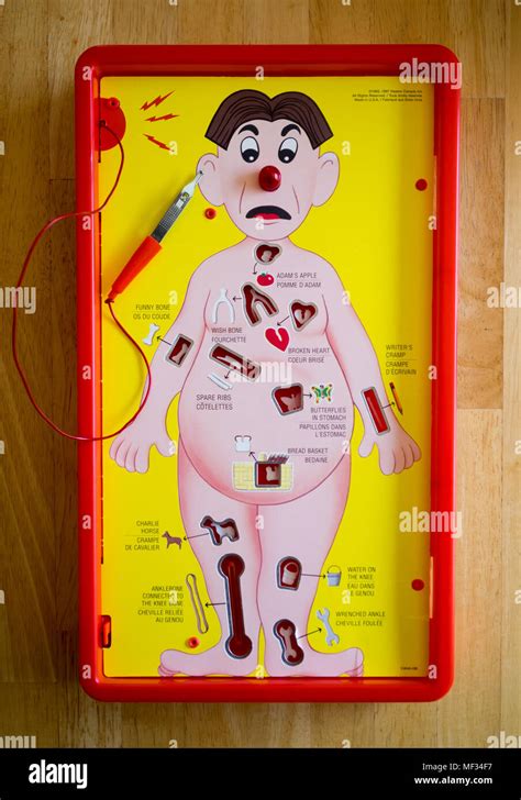 Operation, a battery-operated board game initially produced by Milton ...