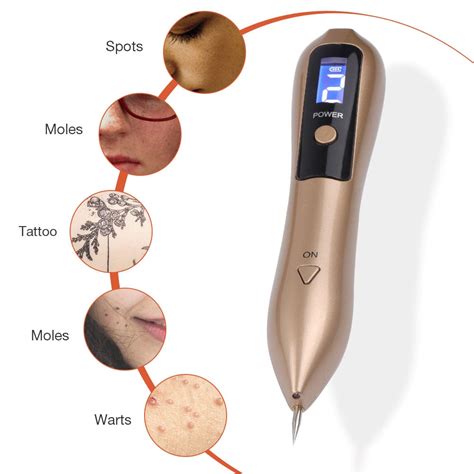 Plasma Pen Skin Tag & Mole Remover, Skin Tag Removal Tool - BodWellbeing