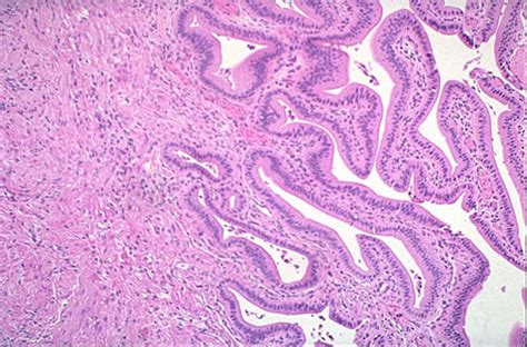 Histology Of Gallbladder