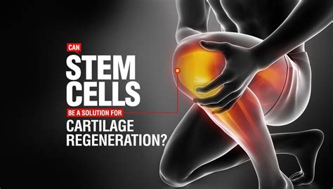 Blog | Can Stem Cells be a Solution for Cartilage Regeneration?