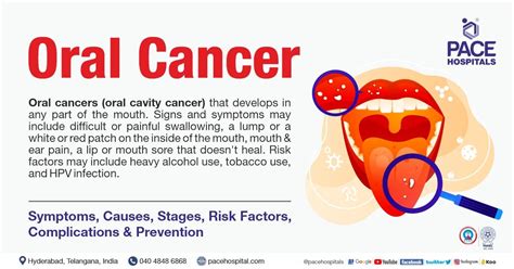 Symptoms Of Mouth Cancer Pictures - Infoupdate.org