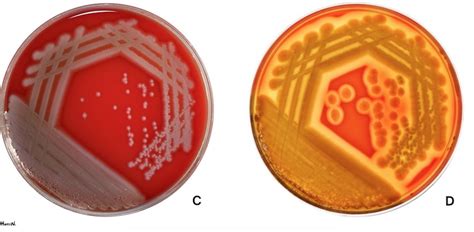 Blood and Bacteria: Blood Agar Reveals How Microbes “Consume” Blood ...