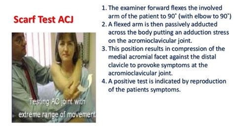 02. shoulder examination