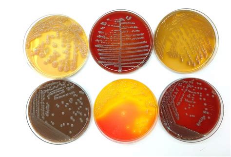 Culture Media In Microbiology - Solution Parmacy