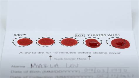 8 Things You Need to Know About Dried Blood Spot Testing | Blog | Ash ...