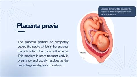 PPT - Complications of The Placenta PowerPoint Presentation, free download - ID:11673439