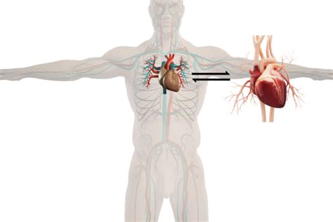 Cardiac Transplant | GlobeHealer